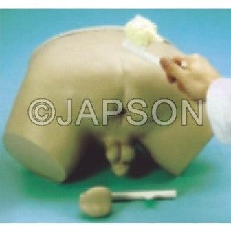 Prostate Inspection Model Prostate Inspection Model